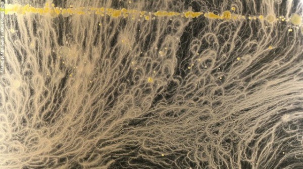These are the bacteria that live on your iPhone 1 phone bacteria