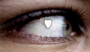 Woman-Gets-Platinum-Jewelry-Implanted-in-Her-Eye