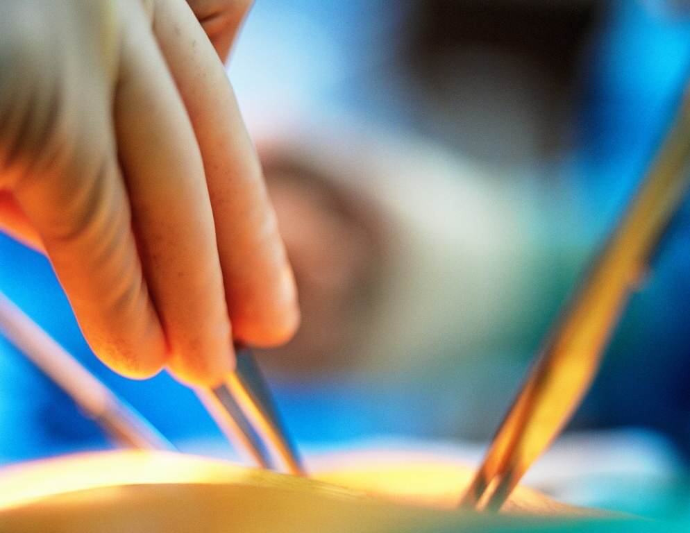 The "black market" for human organs is taking over Facebook 1 transplant