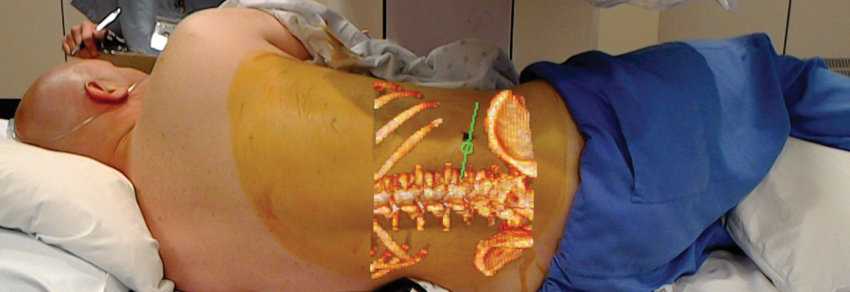 HoloLens app for pre-operative planning approved by FDA 1 HoloLens